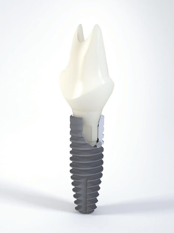 Implant Straumann - sectiune prin implantul dentar Straumann