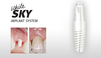 Implant dentar ziconiu alb White Sky de la Bredent, in forma grafica si inserat in gingia unui pacient